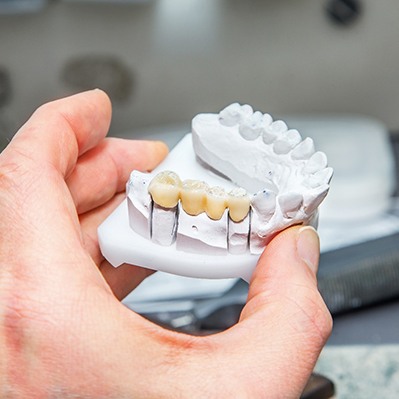 Worcester dentist holding model of dental bridge