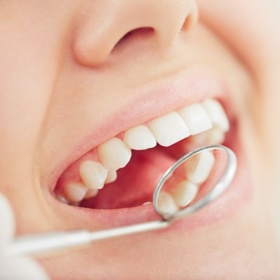 Dentist examining smile after metal free dental restorations