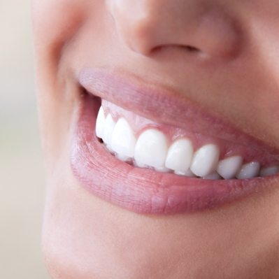 Closeup of bright smile after teeth whitening