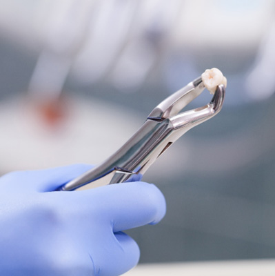 a close-up of a tooth and forceps 