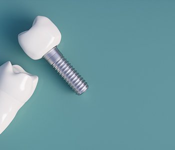 dental implants against a gray background