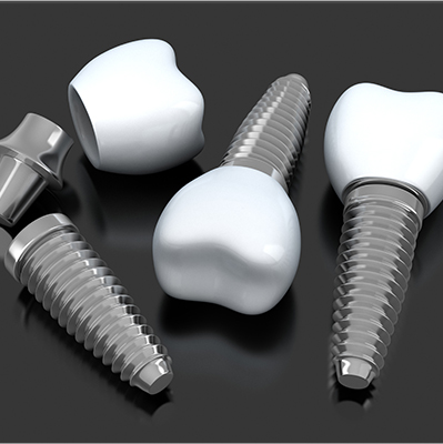 Three animated dental implant supported replacement teeth