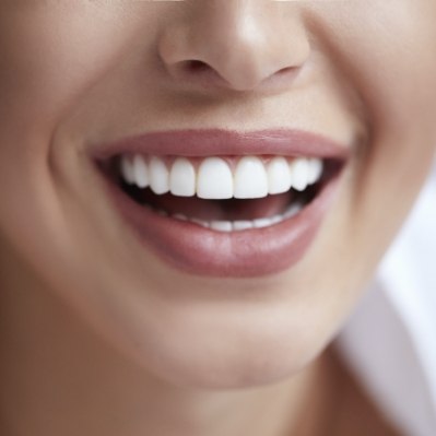 Closeup of healthy smile after scaling and root planing gum disease treatment