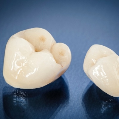 Two dental crowns prior to placement