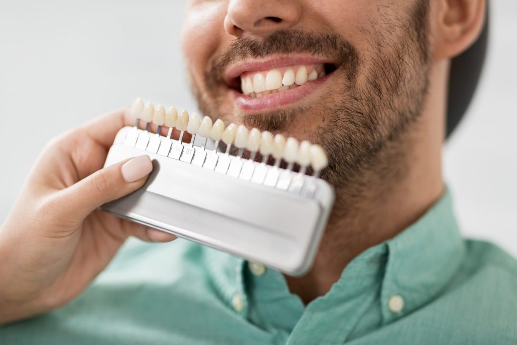 Patient smiling while being color-matched for veneers