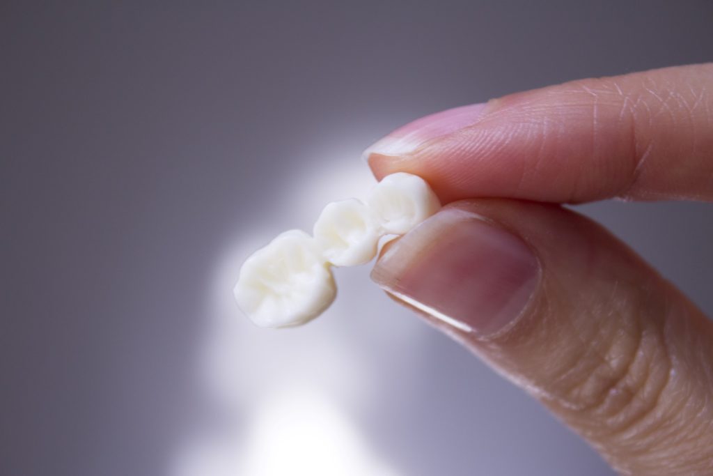 Closeup of woman holding dental bridge